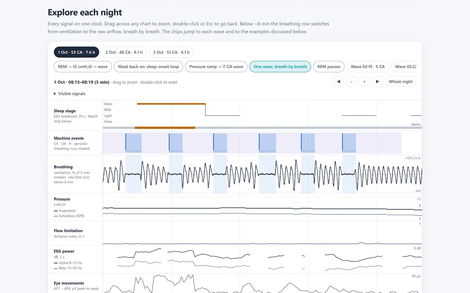 Deep dive: one wave, breath by breath, next to the brain waves (mock data)
